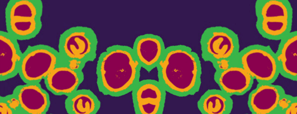 Gonorrhoea bacteria zoomed in.
